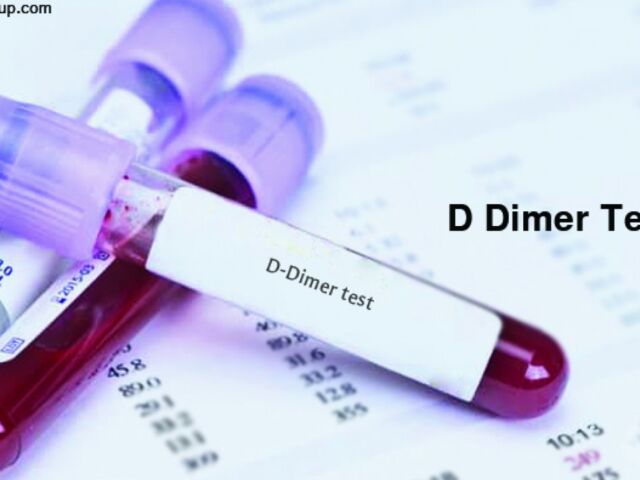 D-Dimer-Test-1280x720