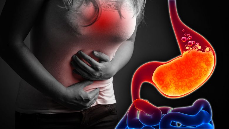 Acid-Reflux-GERD-780x439-1
